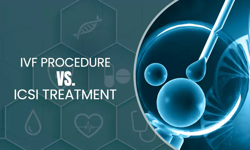 ICSI Treatment and IVF Procedures